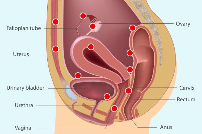 Endometriosis commonly affected areas